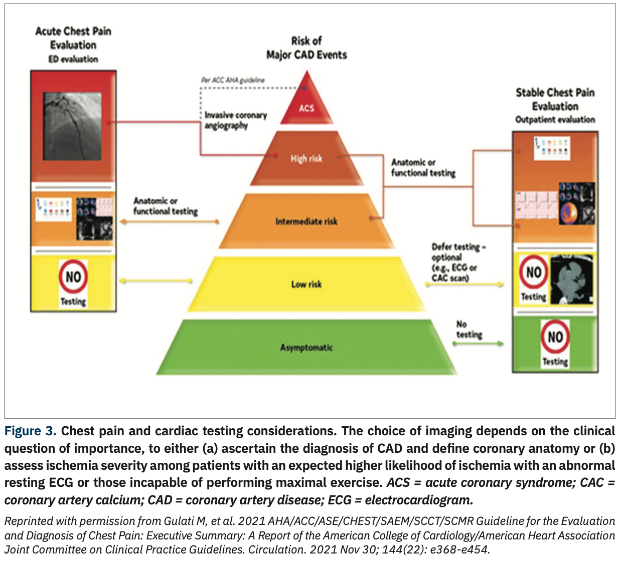 What Does the New 2021 Chest Pain Guideline Say to the Cath Lab?
